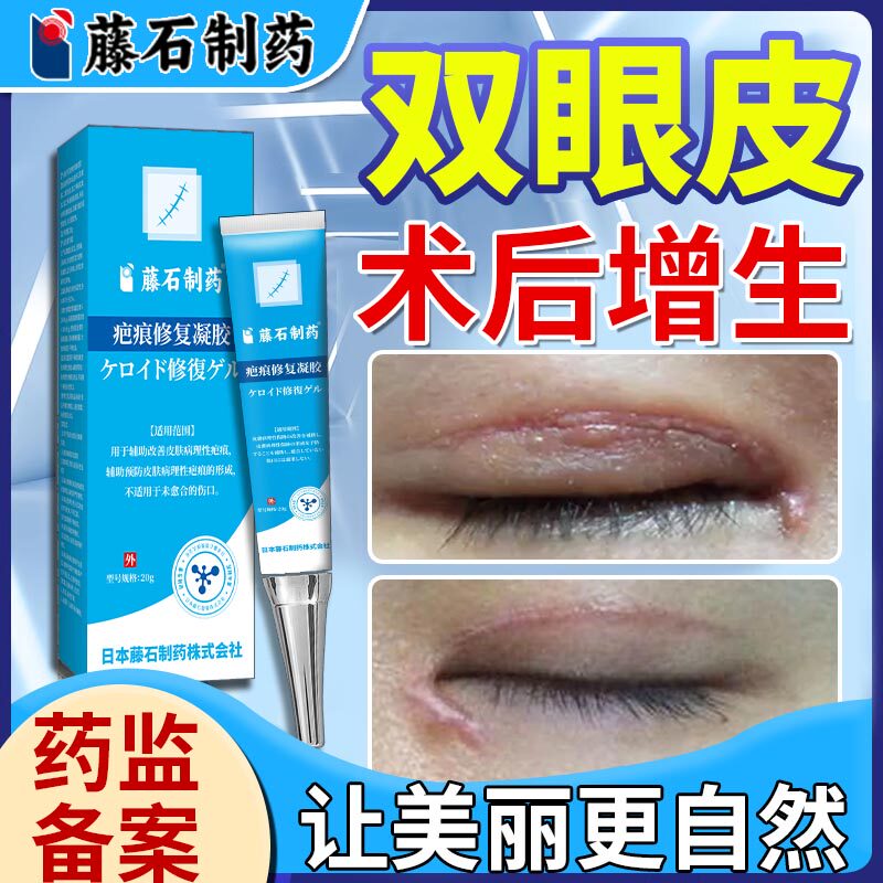 割双眼皮术后祛疤膏疤痕贴消肿神器开眼角疤痕增生凸起去除疙瘩EM