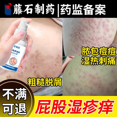 【藤石制药】屁股湿疹长痘痘刺痛