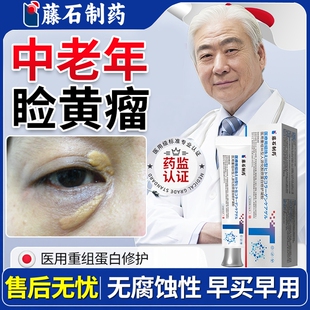 眼睑黄瘤睑黄瘤去除神器睑黄疣眼皮黄斑瘤专用眼部眼角药房款膏OZ