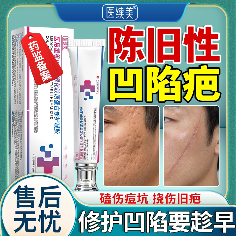 陈旧性凹陷疤痕修复膏除生长疤填充膏胶原蛋白因子凝胶面部神器MP