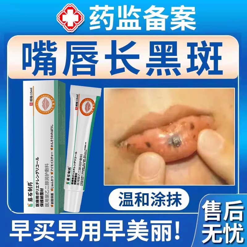 嘴唇黑斑黑点黑色素黑痣唇炎发黑发紫去除淡化周围去黑色素沉淀BS