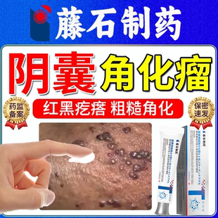 阴囊角化血管瘤黑红小疙瘩血管角化瘤角皮瘤小血泡藤石制药的膏OZ