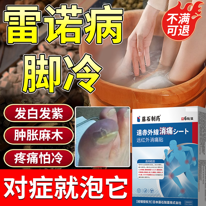 雷诺氏综合征症用病现象手脚麻木专手套可搭中薬膏贴电疗用EM,医疗器械,膏药贴（器械）,淘宝优惠券,粉丝福利购,淘宝优惠卷