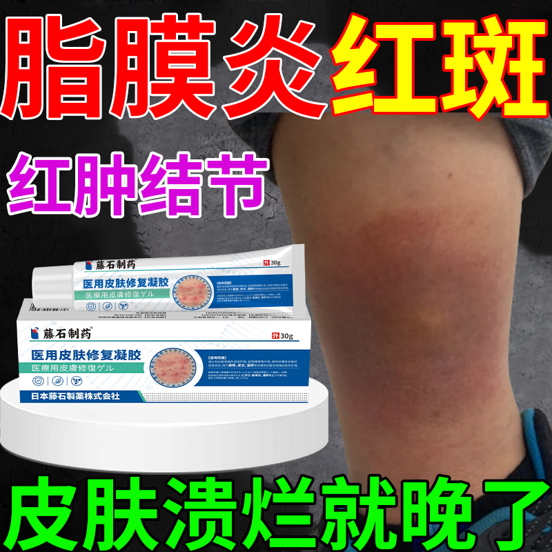 【不满意随时退】腿部红斑