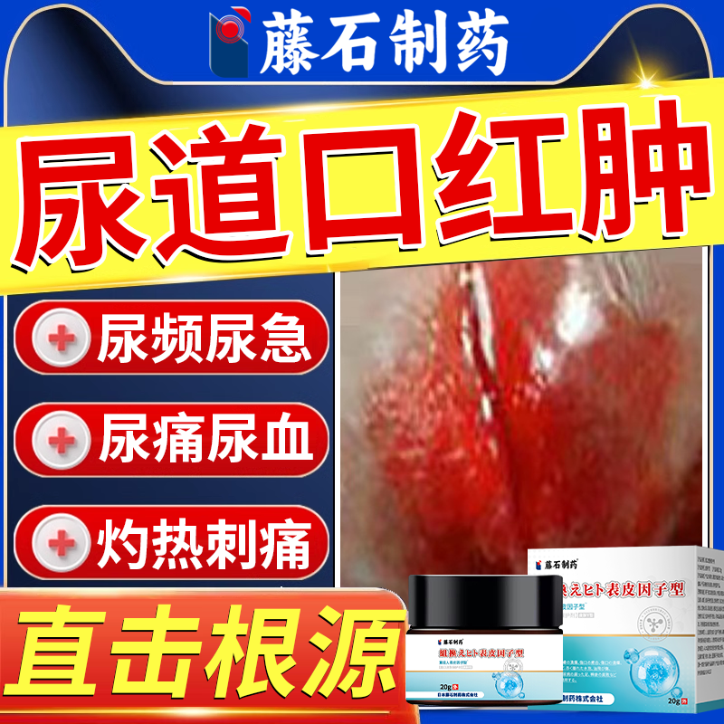 男性尿道口红肿尿道炎流脓性尿路感染专用淋病消特炎效薬房同款em