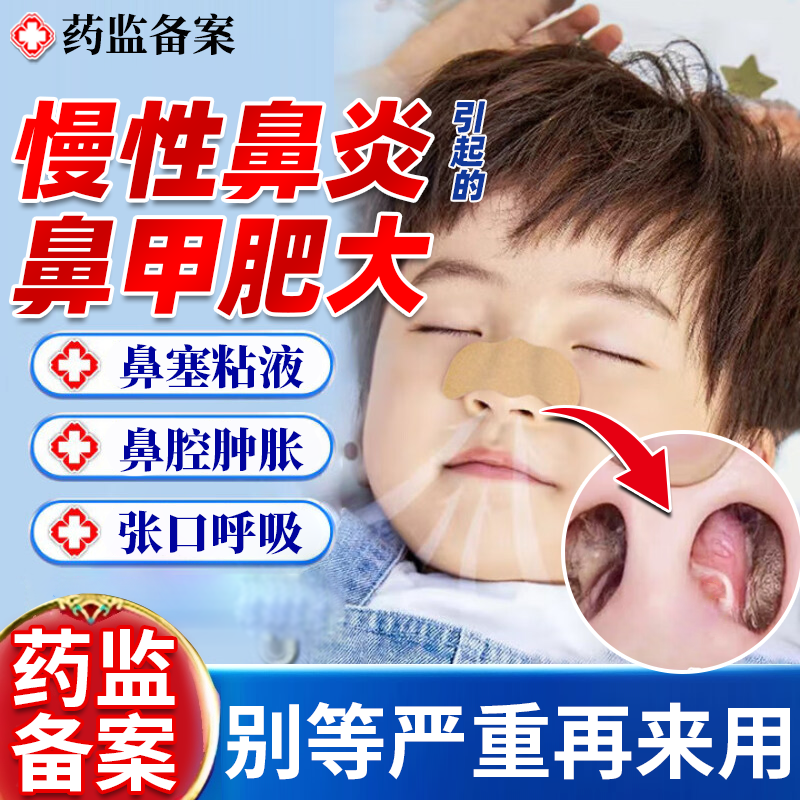 【不满可退】鼻甲肥大热敷鼻贴
