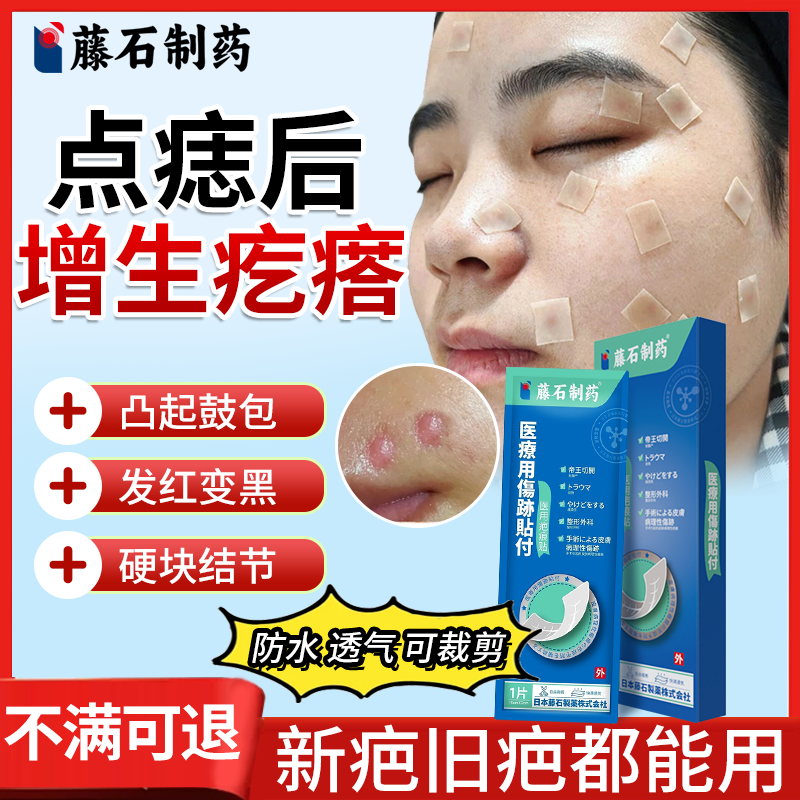 【不满可退】点痣疤痕增生祛疤贴