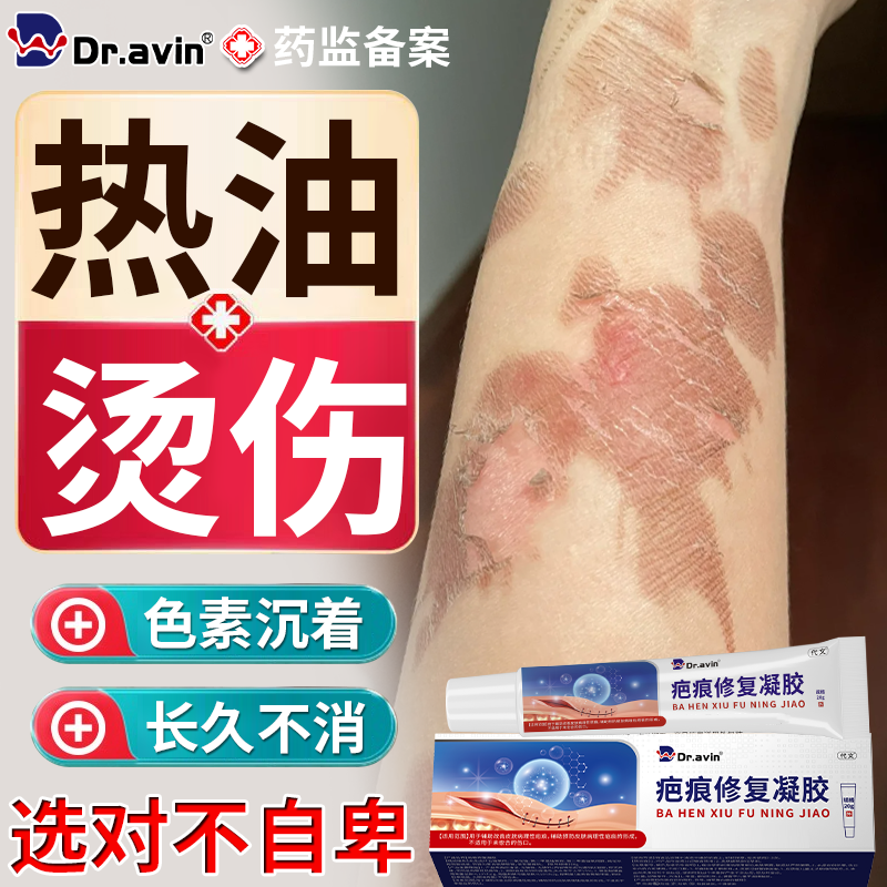 油溅被热油烫伤祛去疤膏脸上去疤痕修烧伤复去印痕黑印色素沉淀BS