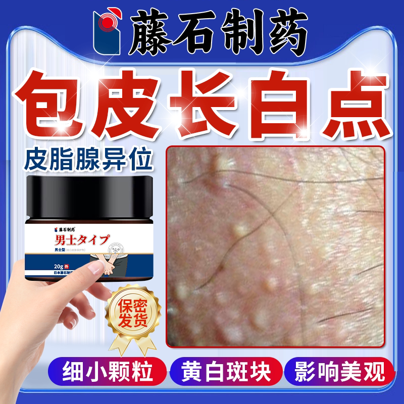 生殖器皮脂腺异位症阴茎包皮有小疙瘩阴囊白色白点脂肪颗粒水泡oz