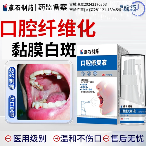 【医用级】口腔黏膜白斑纤维化