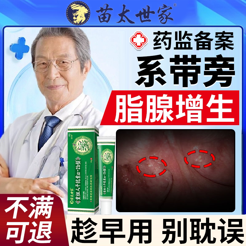 阴茎系带旁腺增生冠状沟皮脂腺异位症颗粒疙瘩黄色丘疹有小疙瘩em