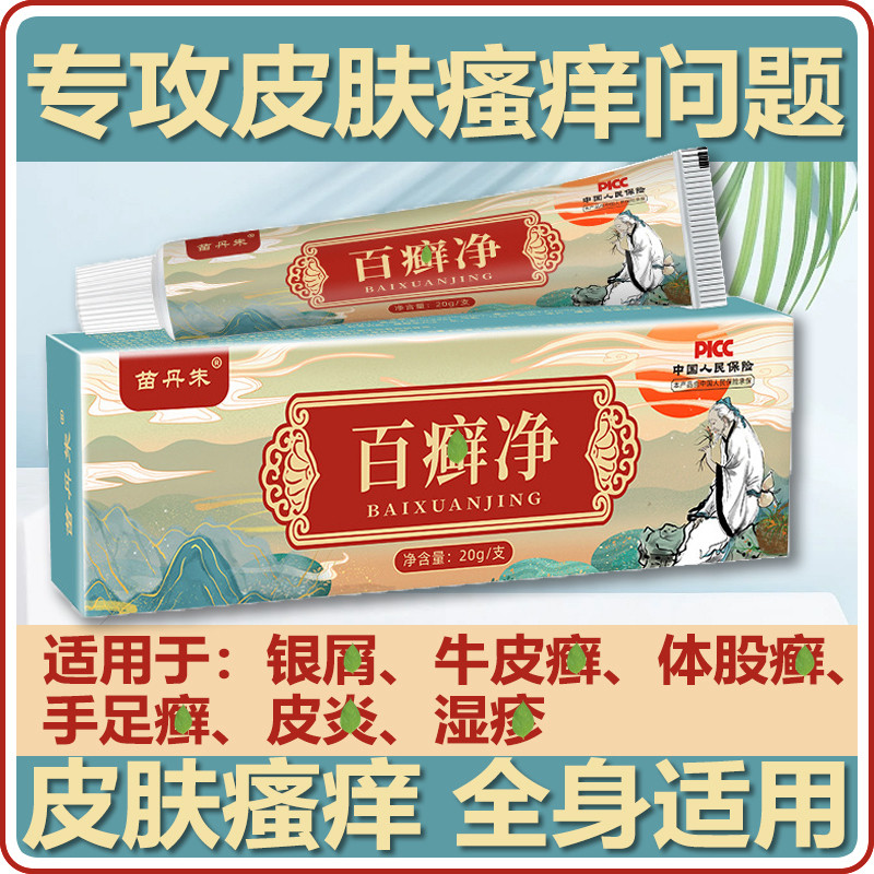 脖子过敏痒脖子红疹夏天出汗浑身痒红脖子起藓长疙瘩抑菌止痒软膏