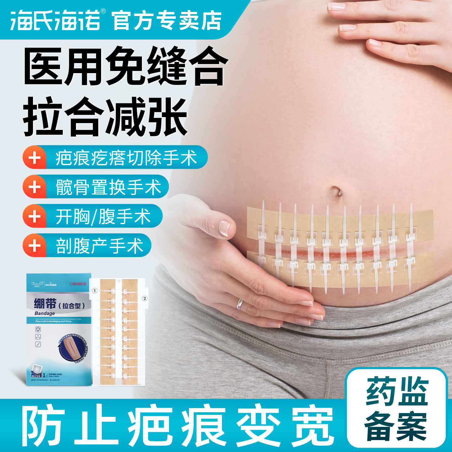 海氏海诺减张器减张贴医用剖腹产术后皮肤疤痕儿童免缝合伤口贴