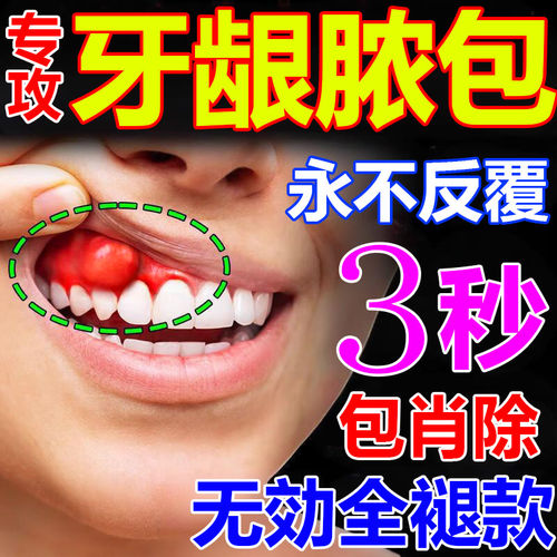 【喷完见效】牙龈肿包消除专用喷