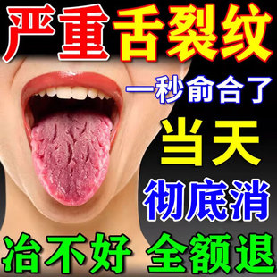 舌苔白厚舌头裂纹有齿痕口臭调理脾胃健去湿气重地图舌专用特效药