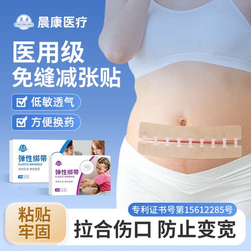 晨康医用拉链式免缝减张器剖腹产