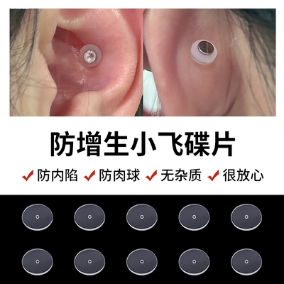 耳洞增生疙瘩耳骨钉唇钉耳蜗钉舌钉小飞碟防增生小飞盘耳钉固定圈
