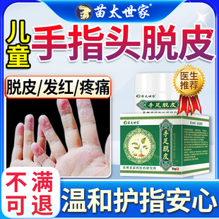 手癣膏脱皮干裂真菌感染儿童专手指尖头用脱皮湿疹止痒膏KV