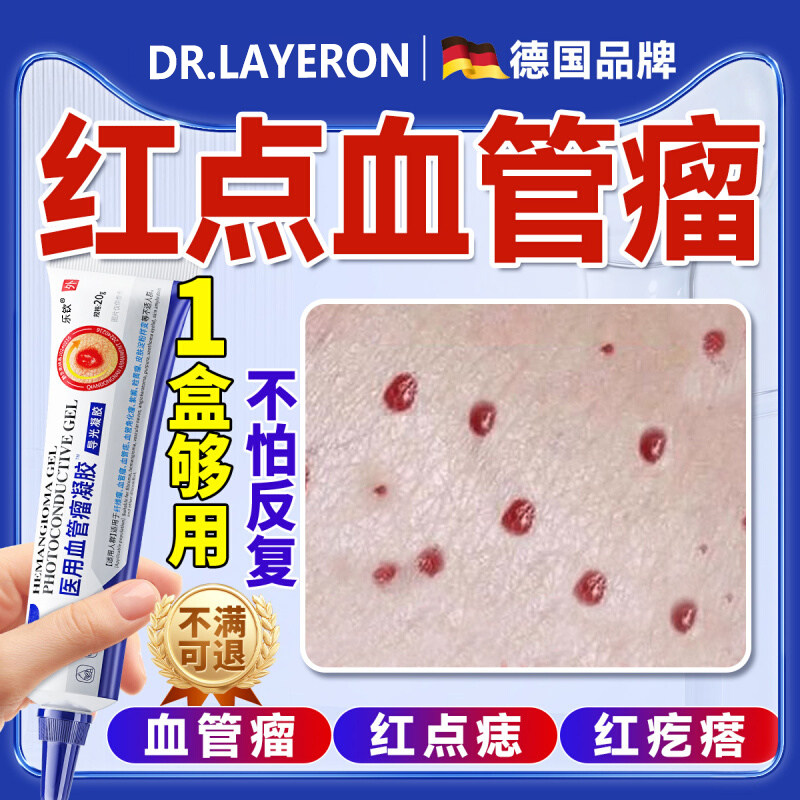 血管瘤痣去除樱桃状点红蜘