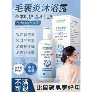 背上长痘痘后背毛囊炎沐浴露胸前皮肤瘙痒非除螨祛痘止沐浴乳8XY