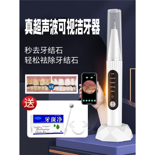 德国可视化牙结石去除器超