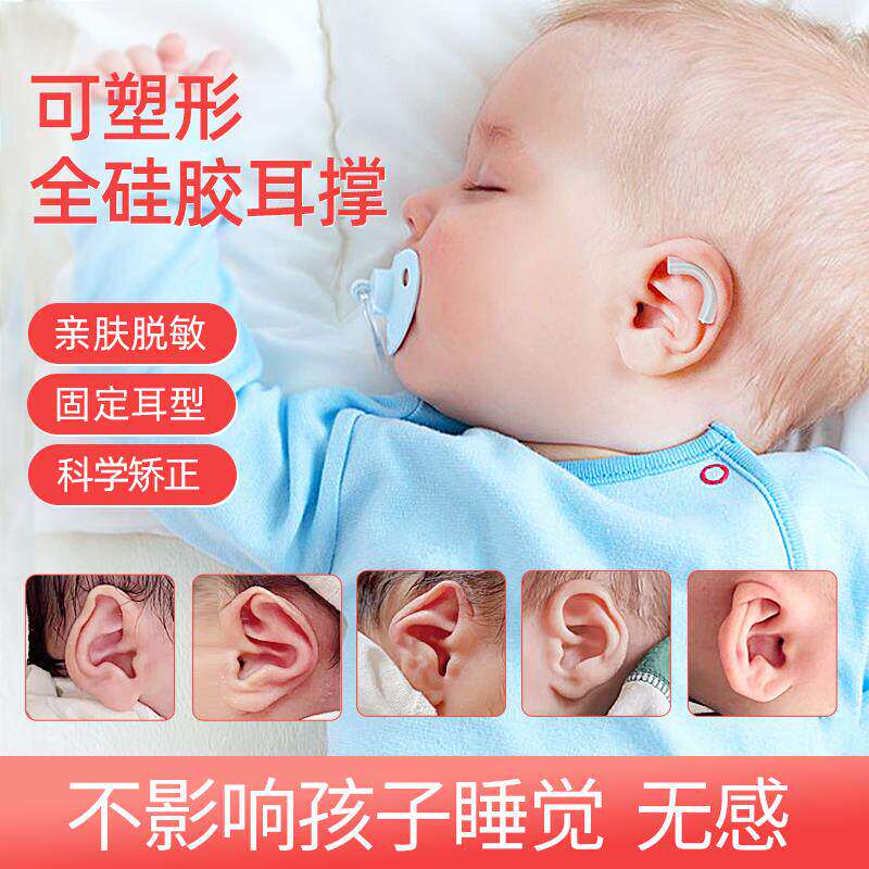 耳朵矫正器婴儿新生儿的矫形器招风耳宝宝定型神器纠正垂耳贴耳廓