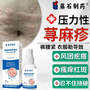 藤石制药荨麻疹压力性寻麻疹过敏止痒喷雾风团水肿皮肤瘙痒喷剂PG