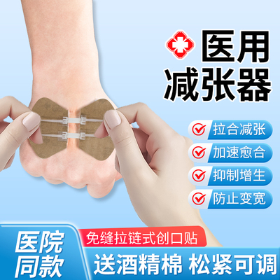 薛湖医用皮肤减张贴剖腹产