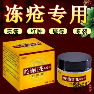 冻疮专用药膏神器止痒治冻伤膏冬季冻手脸部脚冻耳朵防冻冻疮膏