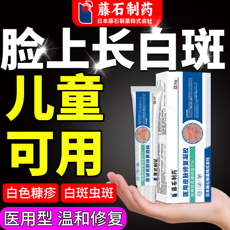白色糠疹药监备案贴儿童小孩脸上长白斑维生素E乳软膏长癣单纯QY