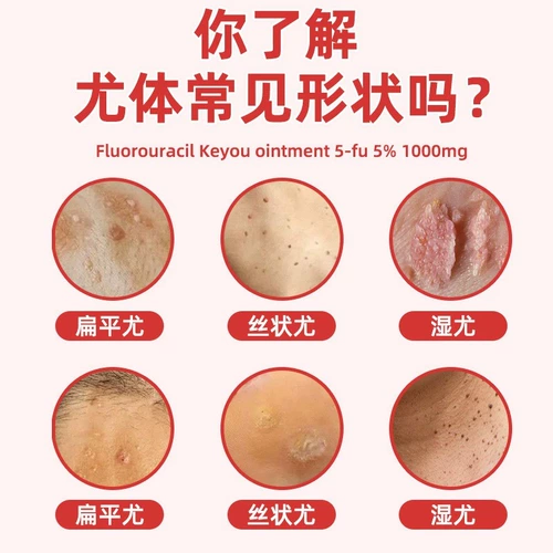 5%еды Matt Molc Мазь подлинная грамм -бородавка