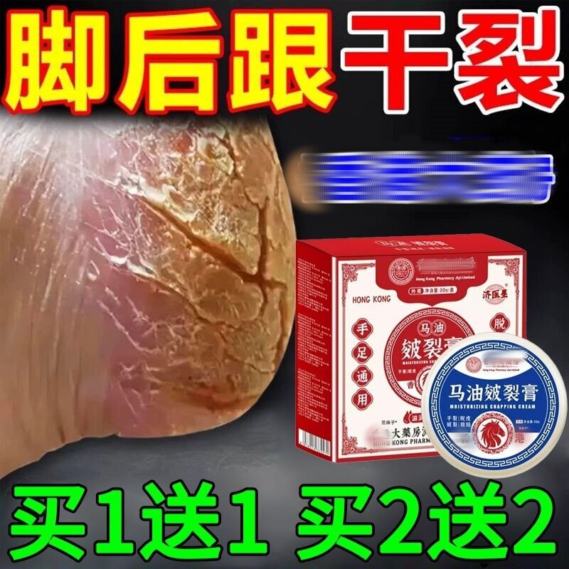 脚后跟干裂修复霜手足龟裂开裂皲裂治手足起皮去死脱皮润马油皱膏