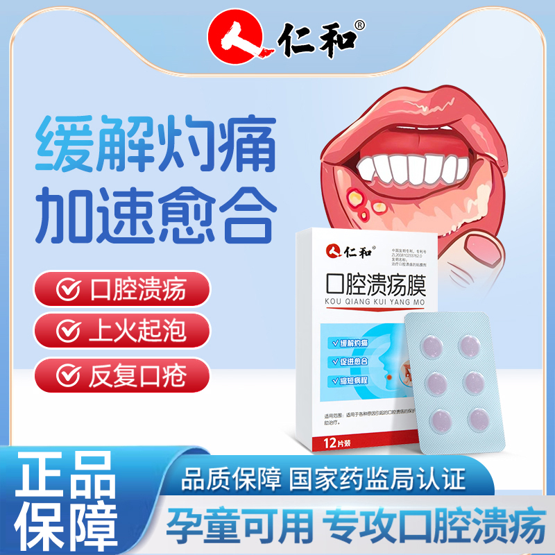 口腔潰瘍專用貼促進愈合不痛