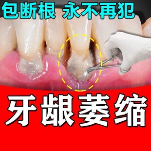 牙龈萎缩修复再生特效药牙根外露黑三角固齿舒适达护理抗敏感牙膏