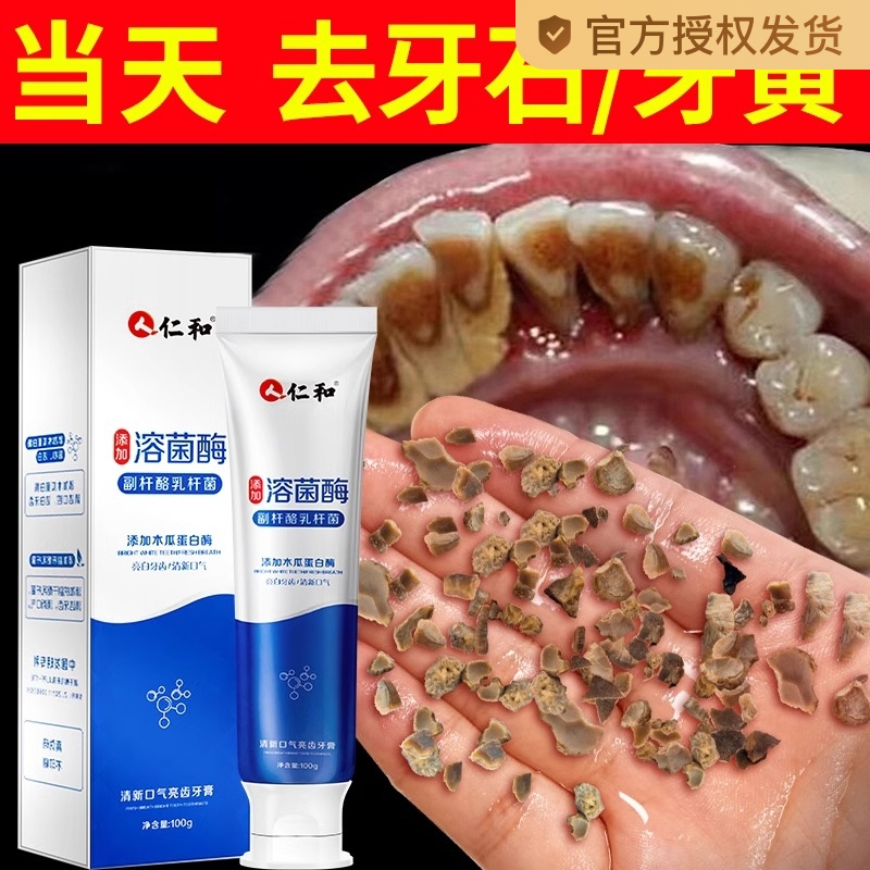 仁和匠心酵素牙膏美白去黄口臭渍成人洗神器官方正品专用牙结石