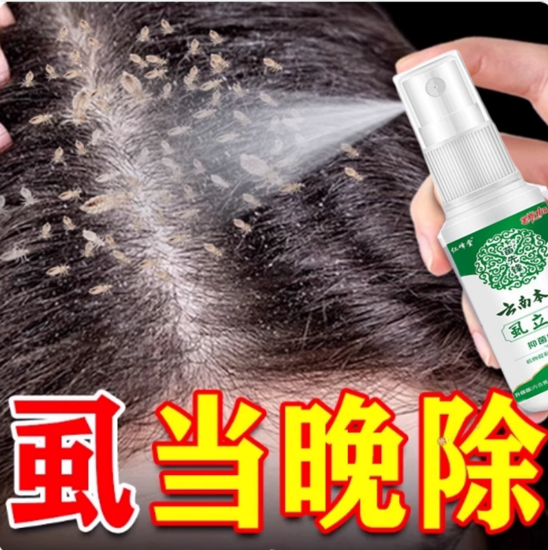 除剪发虫螨虫卷发虫小女孩头上长虱子药的药治儿童男头痒止痒专用