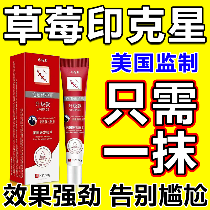 吻痕草莓印消除去草莓印吻痕神器快速消除草莓印脖子专用去疤痕膏