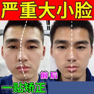 大小脸矫正神器颌垫改善颞下颌关节紊乱下巴脸歪张口受限弹响贴膏