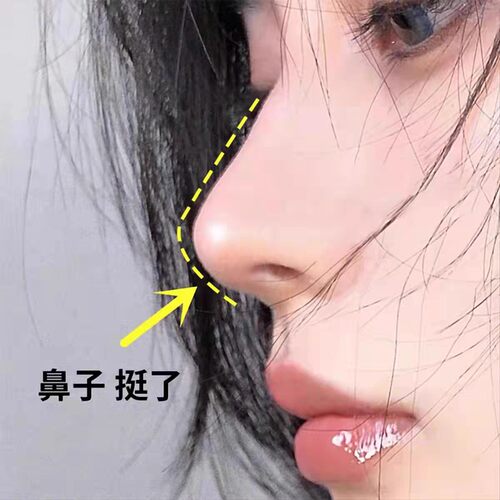 【告别丑鼻子】挺出鼻子新高度 美鼻精华液高山根鼻梁 男女通用