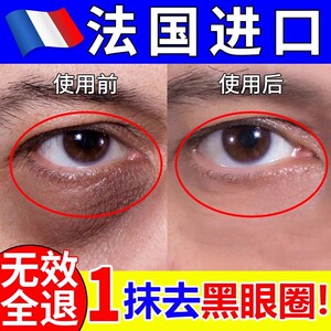 黑眼圈去除男士神器专用抗皱眼霜淡化眼袋提拉紧致官方正品旗舰店