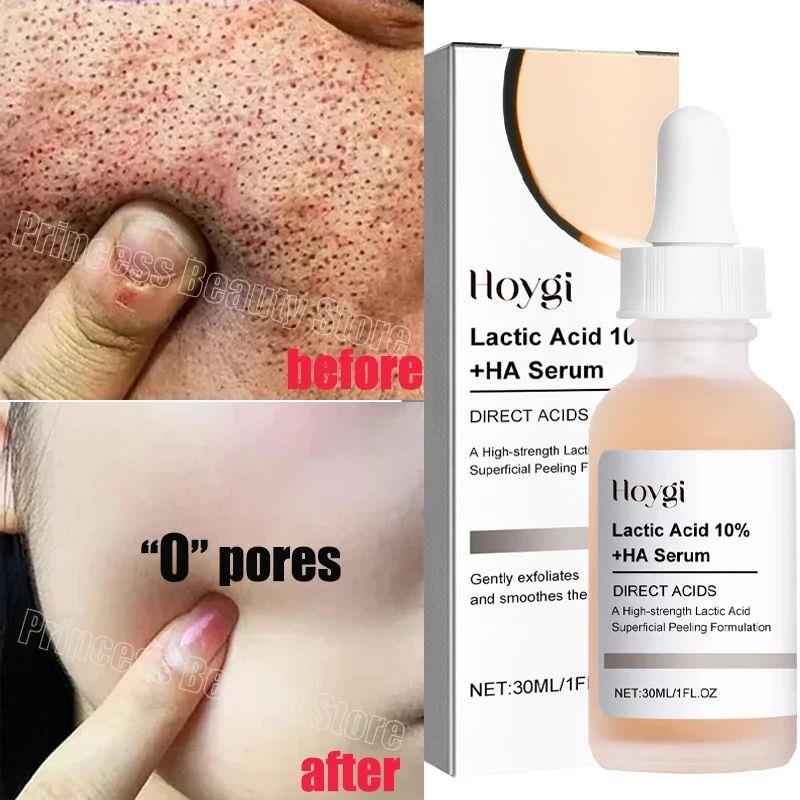 Remove Large Pores Serum Lactic Acid Facial Pore Shrinking