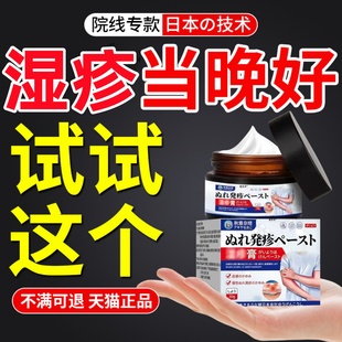 治疗湿疹专用膏特顽固神经性皮炎瘙性皮肤痒无激素去除外用止痒效