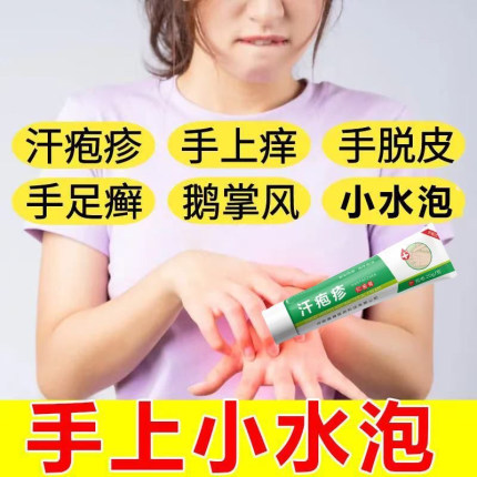 手上起小水泡孢疹汗状汗泡疱疹止痒汉真菌感染汗泡疹药膏湿疹软膏