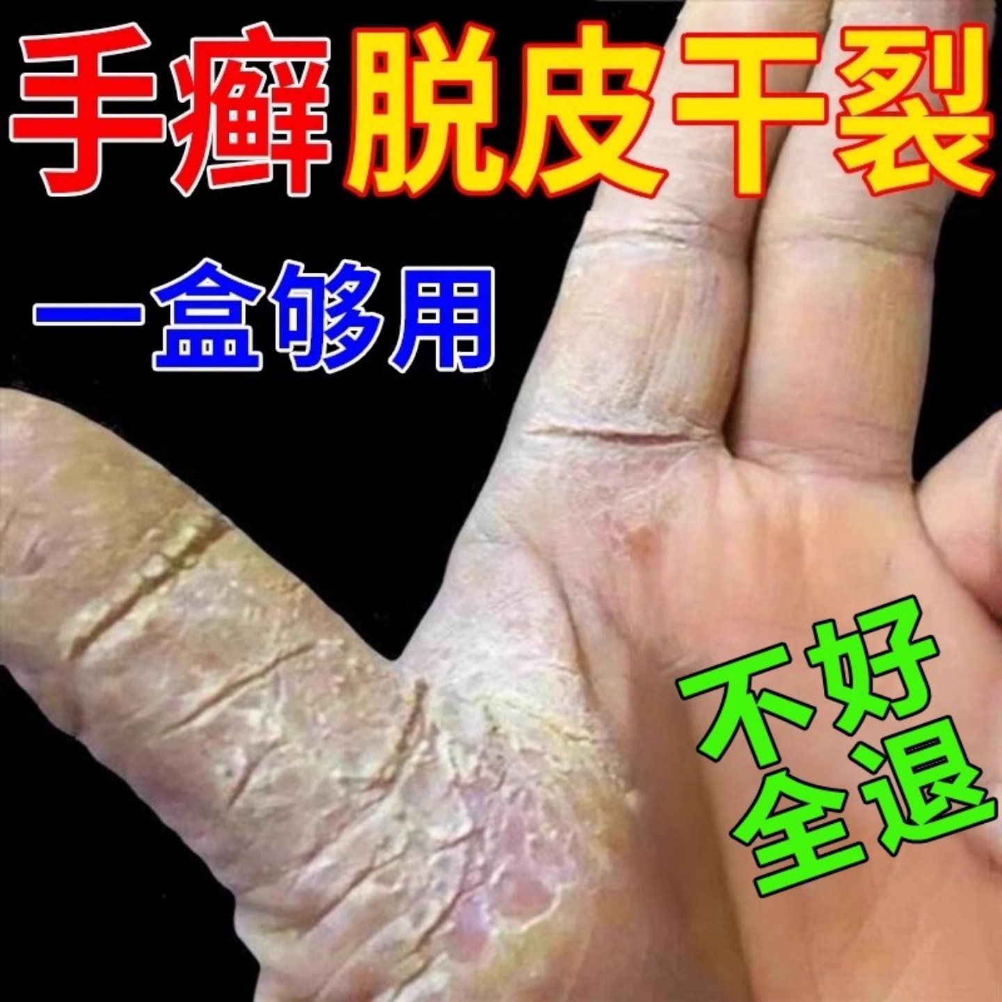 手癣膏脱皮干裂真菌感染手足癣专药监备案用去湿疹止痒根皮肤病,医疗器械,医用乳膏（器械）,淘宝优惠券,粉丝福利购,淘宝优惠卷