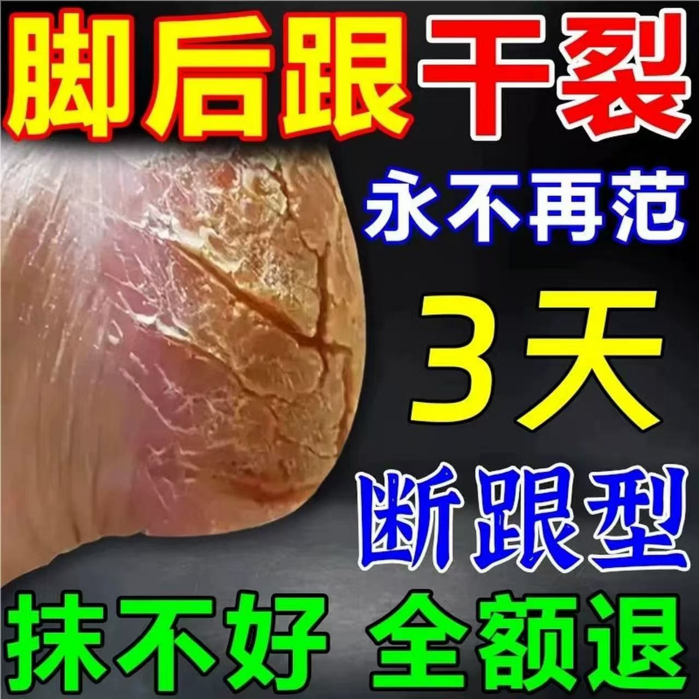 脚后跟干裂膏【仅需一抹】