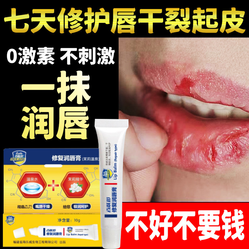 口角炎唇炎专用唇膏儿童烂嘴角疱疹口周炎皮炎干裂脱皮非日本膏