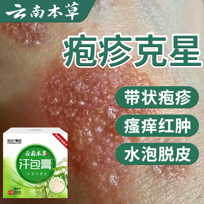 云南本草汗孢汗状疱疹专用抑菌膏