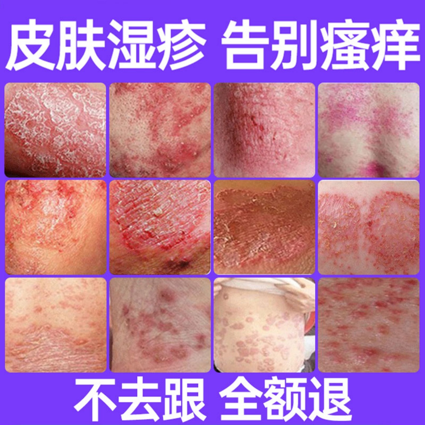 皮康王药膏【皮肤瘙痒救星】