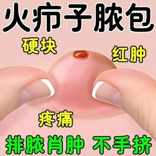 外阴疖肿拔毒膏火疖子药膏拔脓膏脓包硬块敷贴屁股上私处长痘痘贴