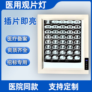 观片灯led超薄医生骨牙科X光CT看片灯遥控调光插片即亮医用阅片灯